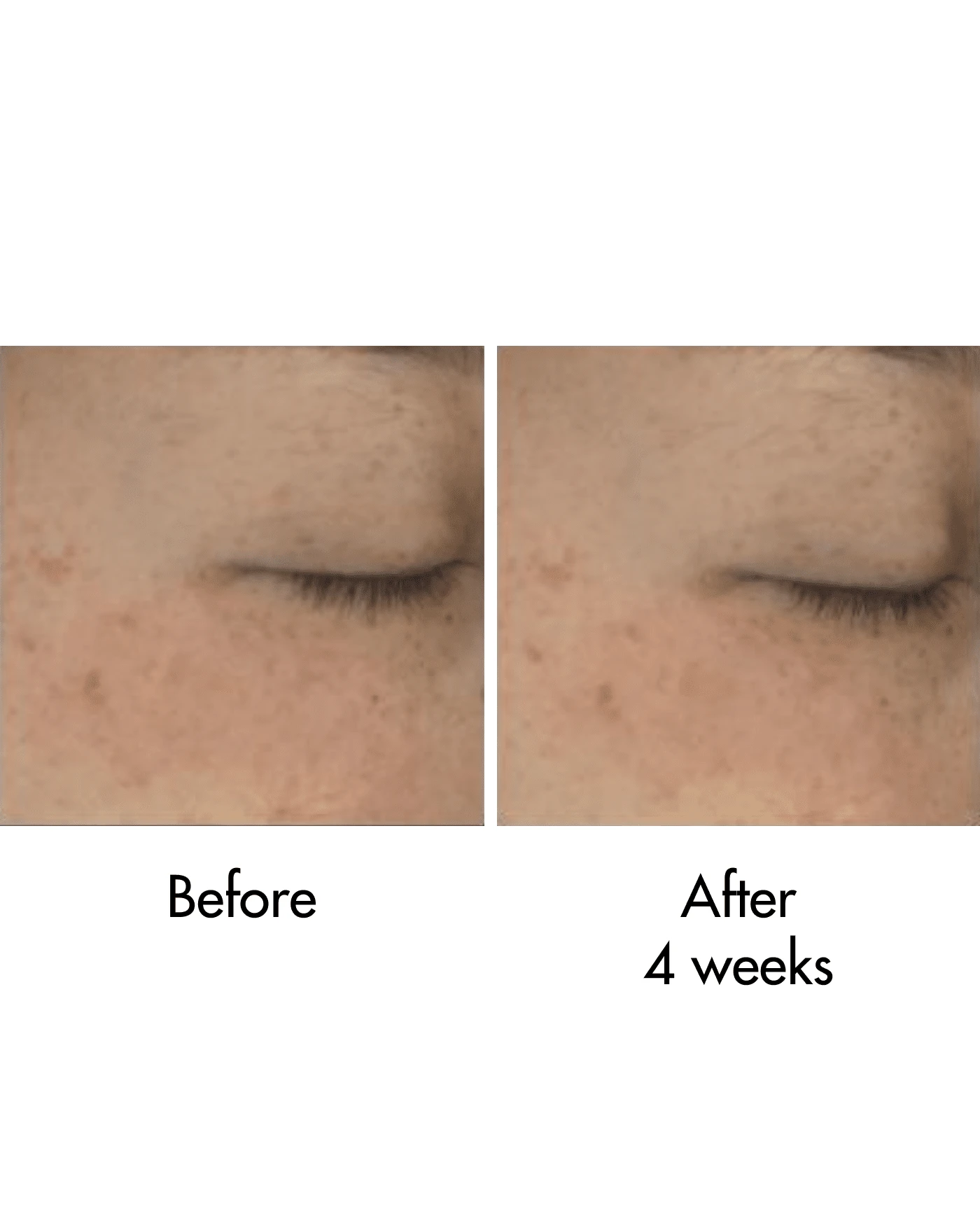 Black Rice Bakuchiol Eye Cream - Image 5